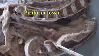 Anatomy labMedian Section of Head and Neckcadaver specimen by DrGosai [upl. by Chauncey]