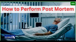 How to run a PostMortem meeting stepbystep [upl. by Marquita572]