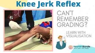 knee jerk reflex I all 4 grades with demo on patients I brisk tendon reflex rootvalue I neurology [upl. by Aissyla]