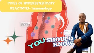 Types of Allergic Reactions Explained  hypersensitivity reactions  immunology [upl. by Harolda785]