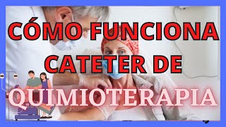 QUIMIOTERAPIA CÓMO FUNCIONA EL CATÉTER [upl. by Nylyaj]