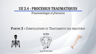 UE 24 S1  Les fractures  Complications et traitements Partie 22 [upl. by Azyl]