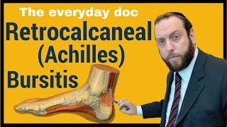 Retrocalcaneal bursitis or Achilles Bursitis [upl. by Akeit]