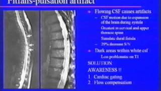 Neuroimaging of Transverse Myelitis Current and Future [upl. by Haleemak316]