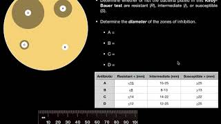 The KirbyBauer Method for Antibiotic Susceptibility with examples [upl. by Airehc]