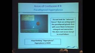 Parathyroid Hyperplasia is Rare Hyperparathyroidism Diagnosis and Treatment [upl. by Darian666]