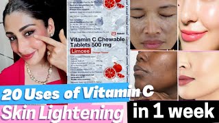 20 Benefits of Vitamin C for Skin  Limcee Vitamin C tablet for Skin remove Tan dark spots Melasma [upl. by Torosian]