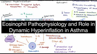 Eosinophil Infiltration and Dynamic Hyperinflation in Asthma [upl. by Eugeniusz841]