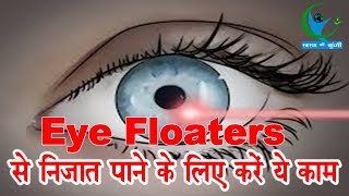 बारबार Eye Floaters की समस्या से हो रहे हैं परेशान तो अपनाएं ये घरेलू उपाय  Eye care Home Remedies [upl. by Durwin]