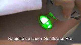 epilation laser au gentlelase proavi [upl. by Lafleur]