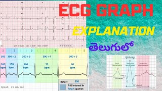 Explain about ECG Graph  How to calculate Heart rate  How to understand ECG ecg heartrate [upl. by Portuna]