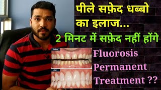 दाँतो के पीले सफ़ेद धब्बो का इलाज । Dental Fluorosis permanent treatment [upl. by Auqinaj63]