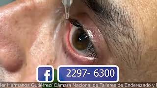 ENDORET PARA EL OJO SECO PTERIGIÓN Y CORNEA SALUD Y ALGO MÁS CANAL 11 Y 4 16 MARZO 2024 [upl. by Tak745]