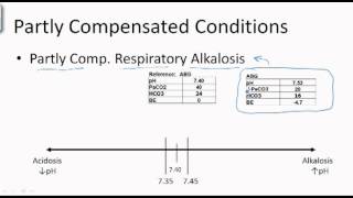 Arterial Blood Gas Classification with Vectors [upl. by Majka675]