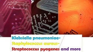 KlebsiellaStaphylococcus Betahaemolytic Streptococci Enterococcus Serratia Micrococcus [upl. by Euqnomod450]