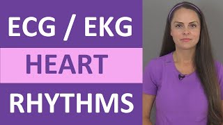 EKG Rhythms  ECG Heart Rhythms Explained  Comprehensive NCLEX Review [upl. by Gabriello]