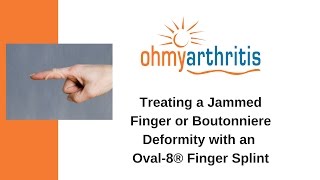 How to Treat a Boutonniere Deformity with an Oval8 Finger Splint  Oh My Arthritis [upl. by Fendig]