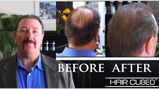 After Hair Transplant With HairCubed Fibers Spray Call 18007191008 [upl. by Aztin]