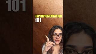 What Is Hyperpigmentation On Face  How Hyperpigmentation Occurs trendingshorts [upl. by Novah]