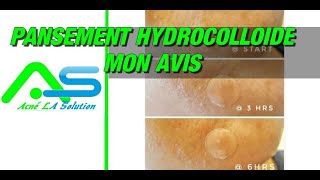 Pansement hydrocolloïde contre lacné mon avis [upl. by Raquel]