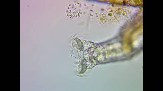 Rotifers Head and Cilia  Close View Under a Microscope [upl. by Hatokad369]