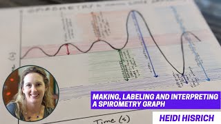 Spirometry How to DrawInterpret a Lung Capacity Graph [upl. by Eimam]