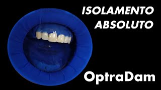 Isolamento Absoluto OptraDam [upl. by Lenroc]