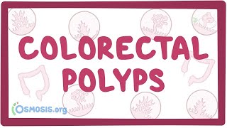 Colorectal polyps  an Osmosis Preview [upl. by Shelbi]