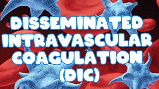 Disseminated intravascular coagulation DIC HEMATOLOGY [upl. by Anelyak]