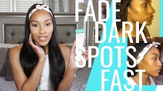 Fade Dark Spots FAST  MDAcne [upl. by Flss260]