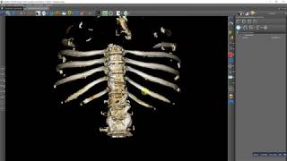 Manual 3D rib cage bones segmentation [upl. by Llet614]