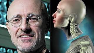 What Happened to the First Human Head Transplant [upl. by Ardme]