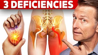 The 3 Vitamin Deficiencies in Sciatica and Carpal Tunnel Syndrome [upl. by Irroc]