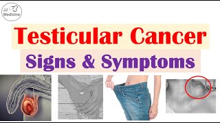 Testicular Cancer Signs and Symptoms Risk Factors amp Metastases [upl. by Arianne]