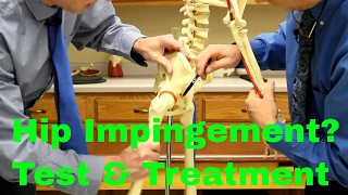 Hip Impingement Causes Treatment amp Test for Femoral Acetabular Syndrome [upl. by Maddalena]