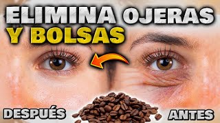 ELIMINA OJERAS BOLSAS y ARRUGAS en MINUTOS ANTIOJERAS EFECTIVO y NATURAL  Cómo quitar las Ojeras [upl. by Ime802]