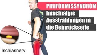 Piriformis Syndrom amp Ischiasschmerzen durch schwache Pomuskulatur  Dehnen hilft NICHT [upl. by Wadleigh]