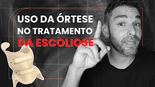 COLETE PARA ESCOLIOSE [upl. by Rosalinde]