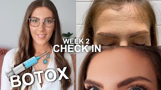 How To Inject Botox Under The Brow  Botox Brow Lift Advice [upl. by Notneiuq324]