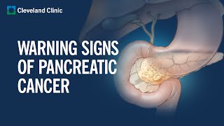 6 Warning Signs of Pancreatic Cancer [upl. by Arymas]