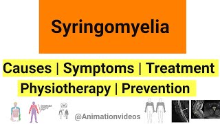 What is Syringomyelia  Pathophysiology  Symptoms  Physiotherapy Treatment [upl. by Netsirhk]