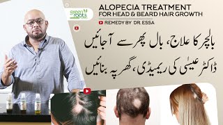 Alopecia treatment for head amp beard hair  alopecia hair growth oil Easy to make remedy by Dr Essa [upl. by Eustatius]