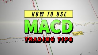 How to Use the MACD on TradingView Identifying Multiple Trading Strategies [upl. by Weisburgh]