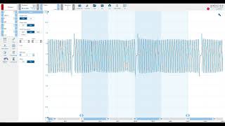 PicoScope 7 Automotive Phase Rulers [upl. by Carmelo]