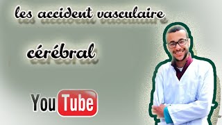 Avc Part 3  infarctus cérébraux constitues [upl. by Mari236]