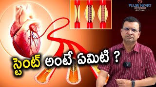 Stent అంటే ఏమిటి Heart కి వేసే Stent ఎలా పని చేస్తుంది  Importance of Stents during Heart Surgery [upl. by Ikairik]