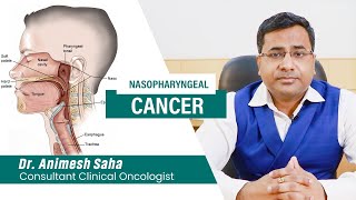 Nasopharyngeal cancer awareness  Best Oncologist in Kolkata  Cancer Specialist in Kolkata [upl. by Asserrac450]