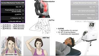 Mechanical Traction  Clinical Prediction Rules CPRs EXPLAINED [upl. by Mckinney]