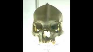 SCP139 quotPossible Skull of the White Divquot [upl. by Louis]