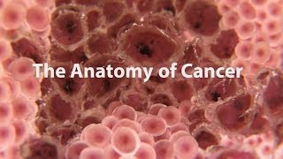 What Is Cancer What Causes Cancer amp How Is It Treated [upl. by Halden]